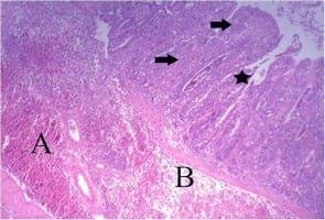 Impact of interaction between aflatoxicosis and cecal coccidiosis on broiler chickens - Image 9