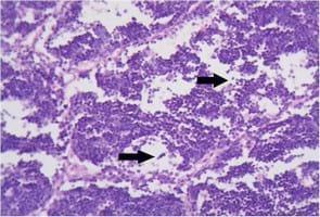 Impact of interaction between aflatoxicosis and cecal coccidiosis on broiler chickens - Image 15