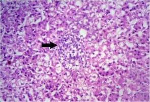 Impact of interaction between aflatoxicosis and cecal coccidiosis on broiler chickens - Image 7
