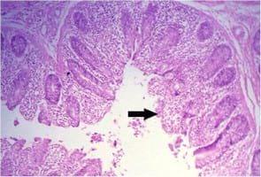 Impact of interaction between aflatoxicosis and cecal coccidiosis on broiler chickens - Image 12