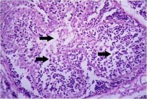 Impact of interaction between aflatoxicosis and cecal coccidiosis on broiler chickens - Image 13