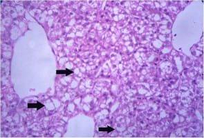 Impact of interaction between aflatoxicosis and cecal coccidiosis on broiler chickens - Image 6