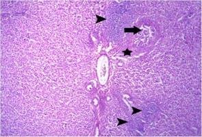 Impact of interaction between aflatoxicosis and cecal coccidiosis on broiler chickens - Image 8