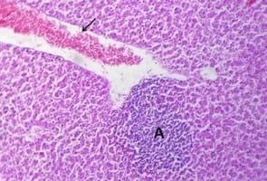 Clinical and laboratory studies on chicken Isolates of Clostridium Perfringens in El-Behera, Egypt - Image 13