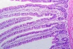 Clinical and laboratory studies on chicken Isolates of Clostridium Perfringens in El-Behera, Egypt - Image 16