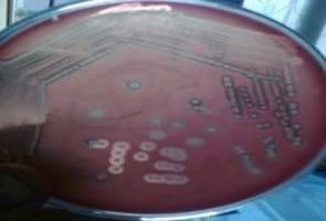 Clinical and laboratory studies on chicken Isolates of Clostridium Perfringens in El-Behera, Egypt - Image 9