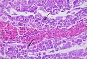Clinical and laboratory studies on chicken Isolates of Clostridium Perfringens in El-Behera, Egypt - Image 12