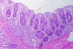 Clinical and laboratory studies on chicken Isolates of Clostridium Perfringens in El-Behera, Egypt - Image 15