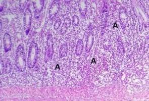 Clinical and laboratory studies on chicken Isolates of Clostridium Perfringens in El-Behera, Egypt - Image 14