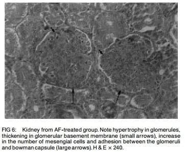 Ameliorative effects of dietary clinoptilolite on pathological changes in broiler chickens during aflatoxicosis - Image 5
