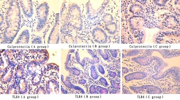 Effects of Chitosan on Intestinal Inflammation in Weaned Pigs Challenged by Enterotoxigenic Escherichia coli - Image 6