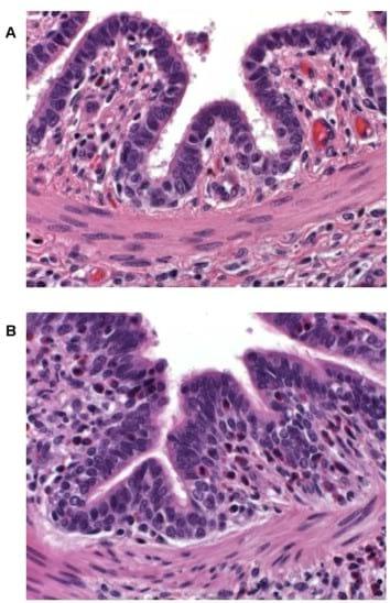 Lactobacillus rhamnosus HN001 Attenuates Allergy Development in a Pig Model - Image 2