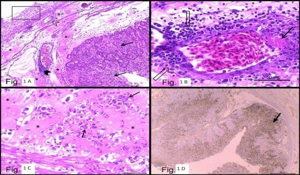 Clinical observations and pathology of the reproductive tract associated with natural infection of an avian influenza (AI) virus in an AI vaccinated layer flock - Image 1