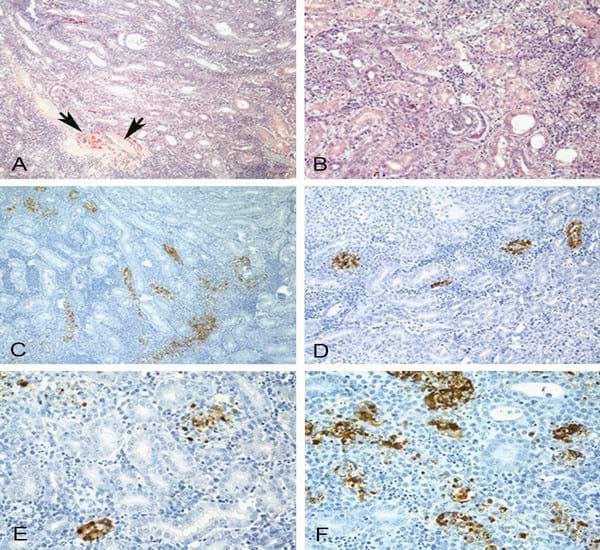 Impact of route of exposure and challenge dose on the pathogenesis of H7N9 low pathogenicity avian influenza virus in chickens - Image 10