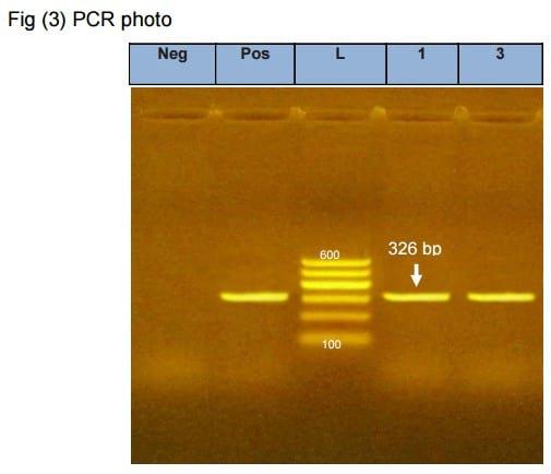 Serological and molecular studies on avian leucosis virus in broiler chicken in Egypt - Image 7