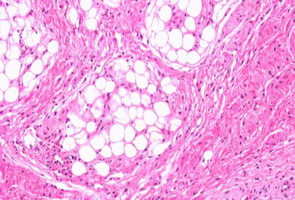 Study of animal welfare through analysis and comparison of the presence of foot pad dermatitis in broilers raised in controlled environments in Brazil and Spain - Image 2