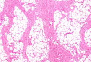Study of animal welfare through analysis and comparison of the presence of foot pad dermatitis in broilers raised in controlled environments in Brazil and Spain - Image 1