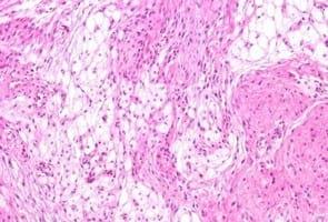 Study of animal welfare through analysis and comparison of the presence of foot pad dermatitis in broilers raised in controlled environments in Brazil and Spain - Image 7