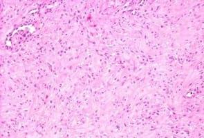 Study of animal welfare through analysis and comparison of the presence of foot pad dermatitis in broilers raised in controlled environments in Brazil and Spain - Image 10