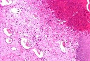 Study of animal welfare through analysis and comparison of the presence of foot pad dermatitis in broilers raised in controlled environments in Brazil and Spain - Image 6