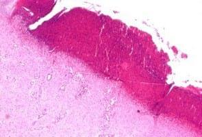 Study of animal welfare through analysis and comparison of the presence of foot pad dermatitis in broilers raised in controlled environments in Brazil and Spain - Image 8