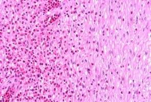 Study of animal welfare through analysis and comparison of the presence of foot pad dermatitis in broilers raised in controlled environments in Brazil and Spain - Image 9