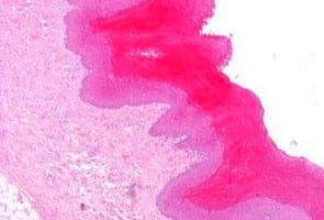Study of animal welfare through analysis and comparison of the presence of foot pad dermatitis in broilers raised in controlled environments in Brazil and Spain - Image 3