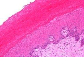 Study of animal welfare through analysis and comparison of the presence of foot pad dermatitis in broilers raised in controlled environments in Brazil and Spain - Image 4