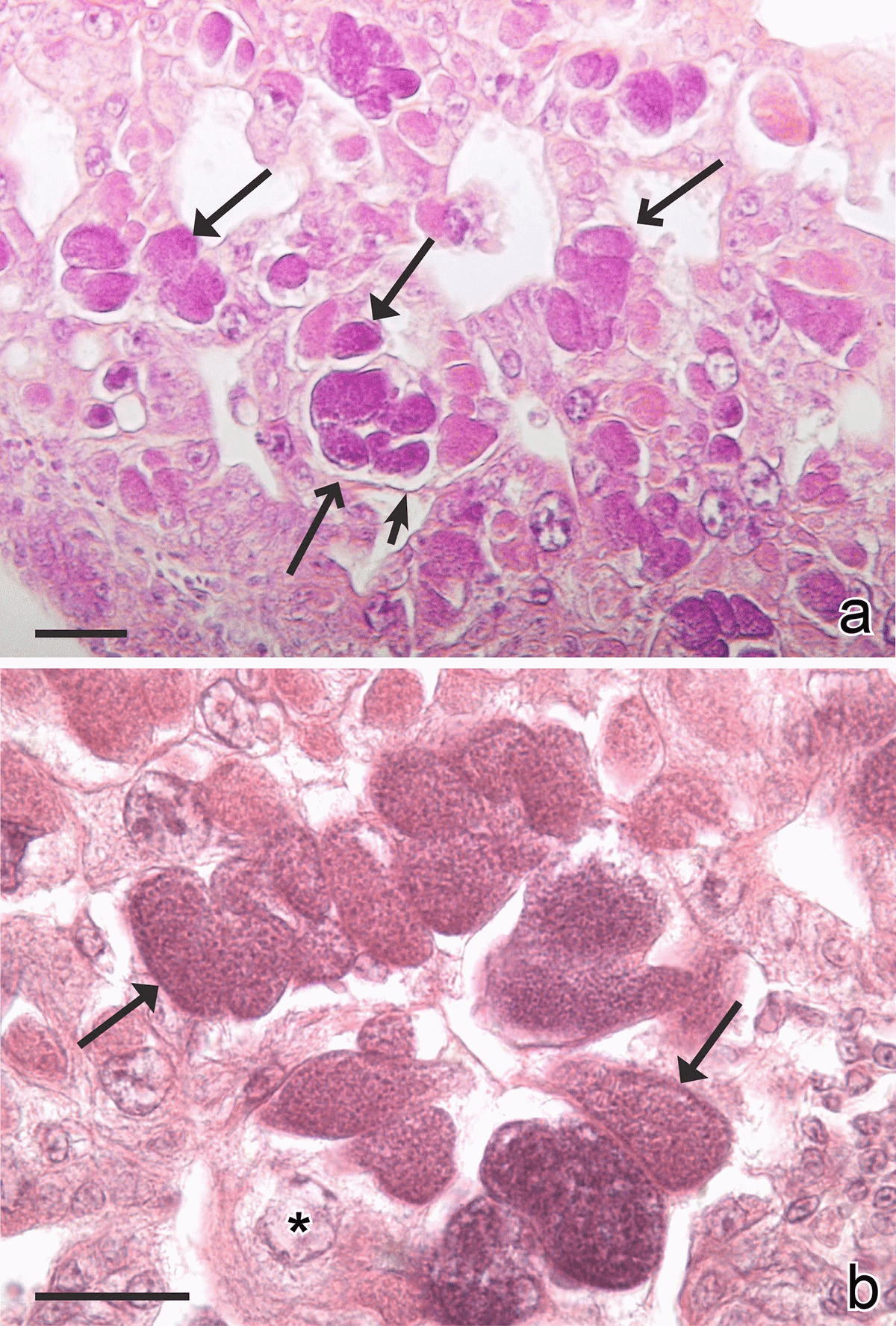 Exo-erythrocytic development of avian malaria and related haemosporidian parasites - Image 14