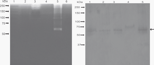 Outer membrane vesicles of Pasteurella multocida contain virulence factors - Image 5