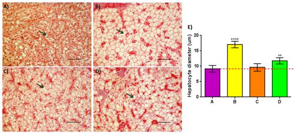 Nutrigenomic and Nutritional Analyses Reveal the Effects of Pelleted Feeds on Asian Seabass (Lates calcarifer) - Image 10