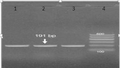 Mycoplasma Synoviae and other Associated Bacteria Causing Arthritis in Chicken - Image 11