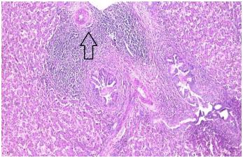 Pathogenicity of Ten Gallibacterium Anatis Isolates in Commercial Broiler Chickens - Image 8