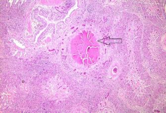 Pathogenicity of Ten Gallibacterium Anatis Isolates in Commercial Broiler Chickens - Image 7