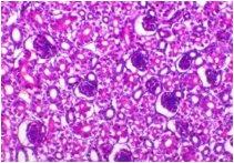 Incidence of Avian Nephritis and Infectious Bronchitis Viruses in Broilers in Egypt - Image 13