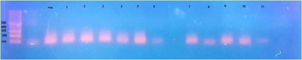 Incidence of Avian Nephritis and Infectious Bronchitis Viruses in Broilers in Egypt - Image 10