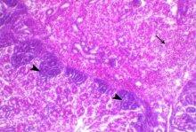 Incidence of Avian Nephritis and Infectious Bronchitis Viruses in Broilers in Egypt - Image 15