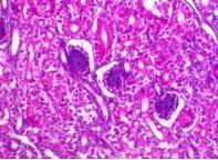 Incidence of Avian Nephritis and Infectious Bronchitis Viruses in Broilers in Egypt - Image 17