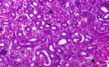 Incidence of Avian Nephritis and Infectious Bronchitis Viruses in Broilers in Egypt - Image 11