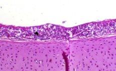 Incidence of Avian Nephritis and Infectious Bronchitis Viruses in Broilers in Egypt - Image 14