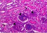 Incidence of Avian Nephritis and Infectious Bronchitis Viruses in Broilers in Egypt - Image 12