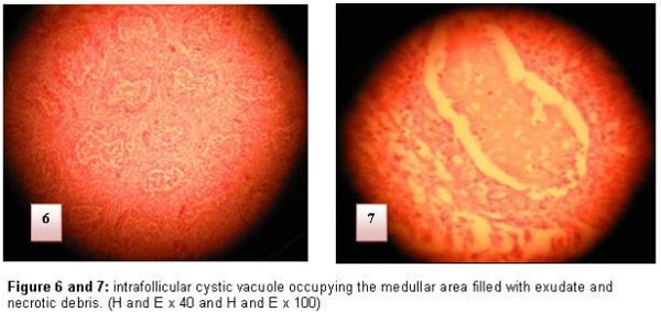 Diagnosis of chicken Gumboro disease by histopathological study of the bursa of Fabricius - Image 5