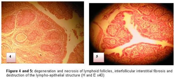 Diagnosis of chicken Gumboro disease by histopathological study of the bursa of Fabricius - Image 4