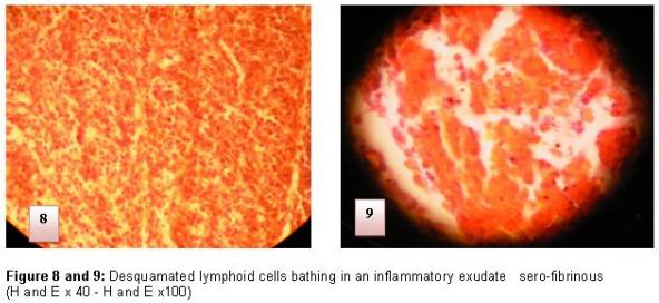Diagnosis of chicken Gumboro disease by histopathological study of the bursa of Fabricius - Image 6