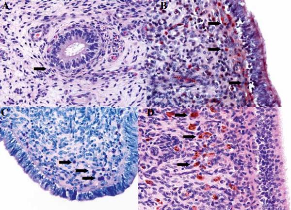 Postpartum uterine diseases in dairy cows: a review with emphasis on subclinical endometritis - Image 3