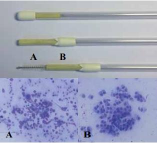 Postpartum uterine diseases in dairy cows: a review with emphasis on subclinical endometritis - Image 6
