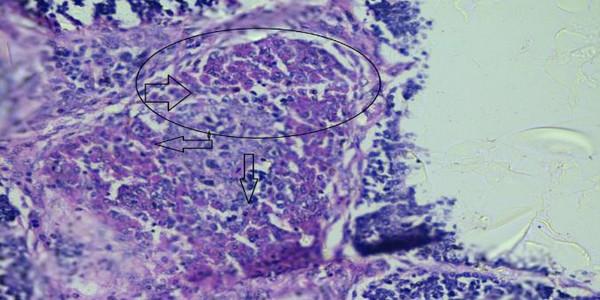 Role of histopathological examination in diagnosis of avian leucosis virus subtype J in broiler chicken in Egypt - Image 31