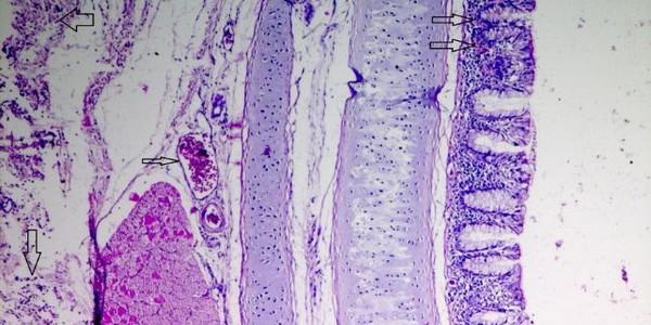 Role of histopathological examination in diagnosis of avian leucosis virus subtype J in broiler chicken in Egypt - Image 25