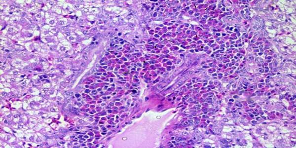 Role of histopathological examination in diagnosis of avian leucosis virus subtype J in broiler chicken in Egypt - Image 6