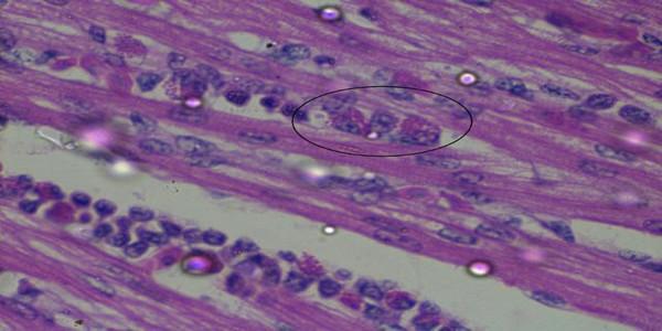 Role of histopathological examination in diagnosis of avian leucosis virus subtype J in broiler chicken in Egypt - Image 13